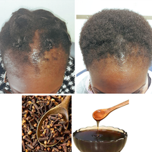 Load image into Gallery viewer, Mama Africa Chebe Powder Natural Herbal Shampoo and Hair Regrowth Oil for Traction Alopecia